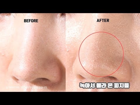 (CHIẾT 100ML) Ủ MỤN ĐẦU ĐEN Medipeel Extra Super 9 100ml [Chính Hãng] [Mẫu mới]