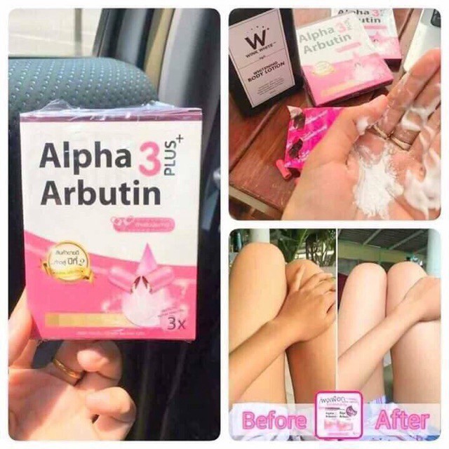10 Viên kích trắng Alpha Abutin