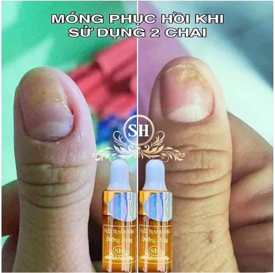 Dưỡng Móng Độc Quyền Thiên DI ,dưỡng dài móng, giúp móng chắc khỏe