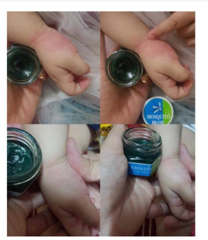 DẦU THOA MUỖI ĐỐT THÁI LAN