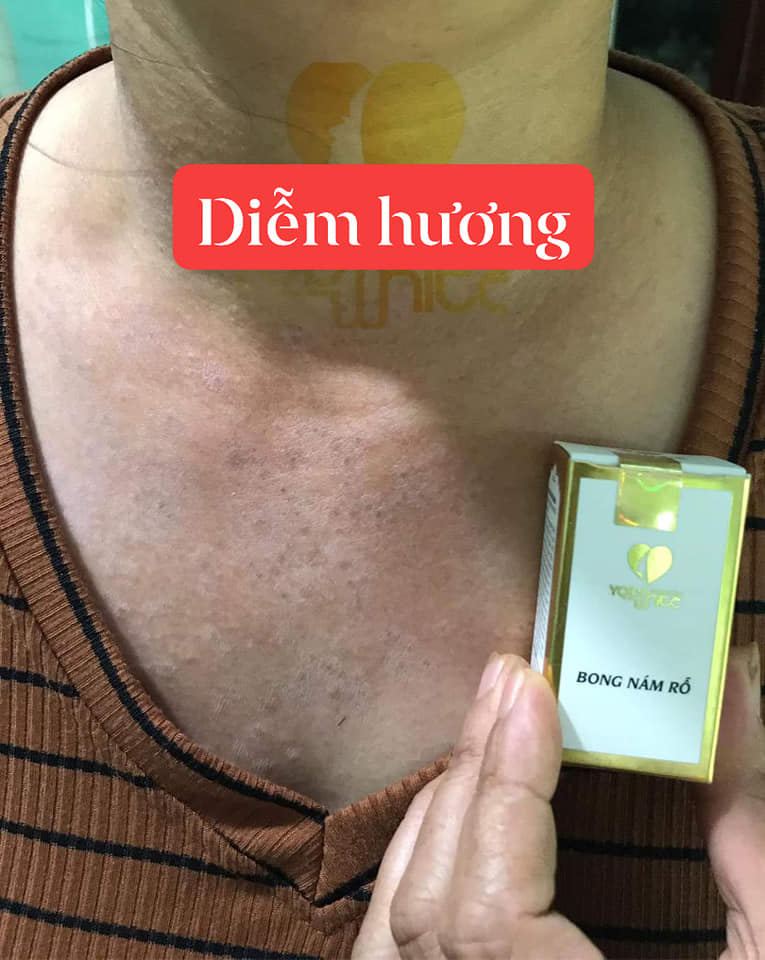 Bong nám rỗ Yody White Phương Anh