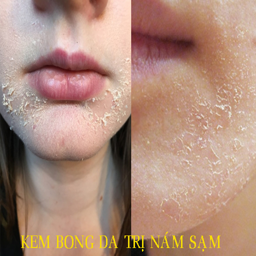 [HCM]Kem vỗ bong da mặt BEZY ThaiLan