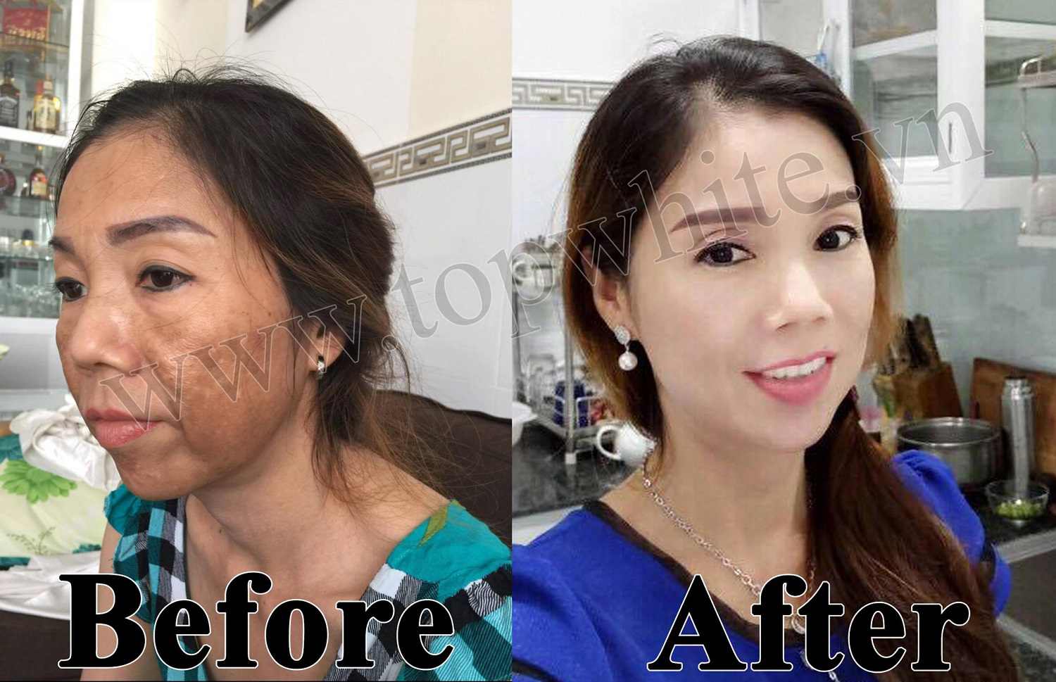 Kem Chống Nắng Top White D3 SPF 50+ PA++++