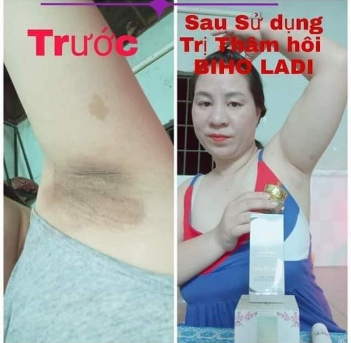 BIHO LADI SIÊU DƯỠNG THÂM 5S, [COMBO 2 HỘP] GIẢM 80K (TẶNG KÈM QUÀ)