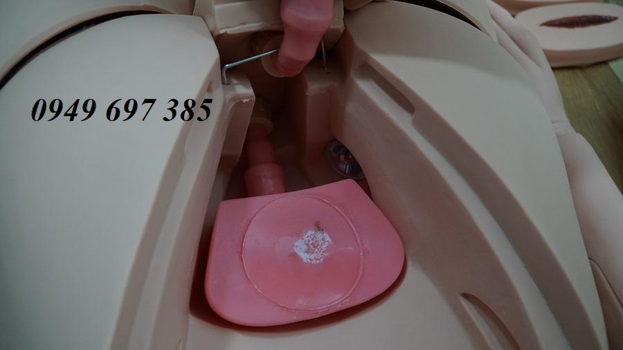 Mô hình thực hành điều dưỡng chăm sóc bệnh nhân