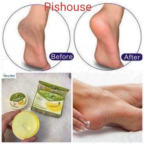 KEM NỨT GÓT CHÂN CHUỐI THÁI LAN hộp 30g