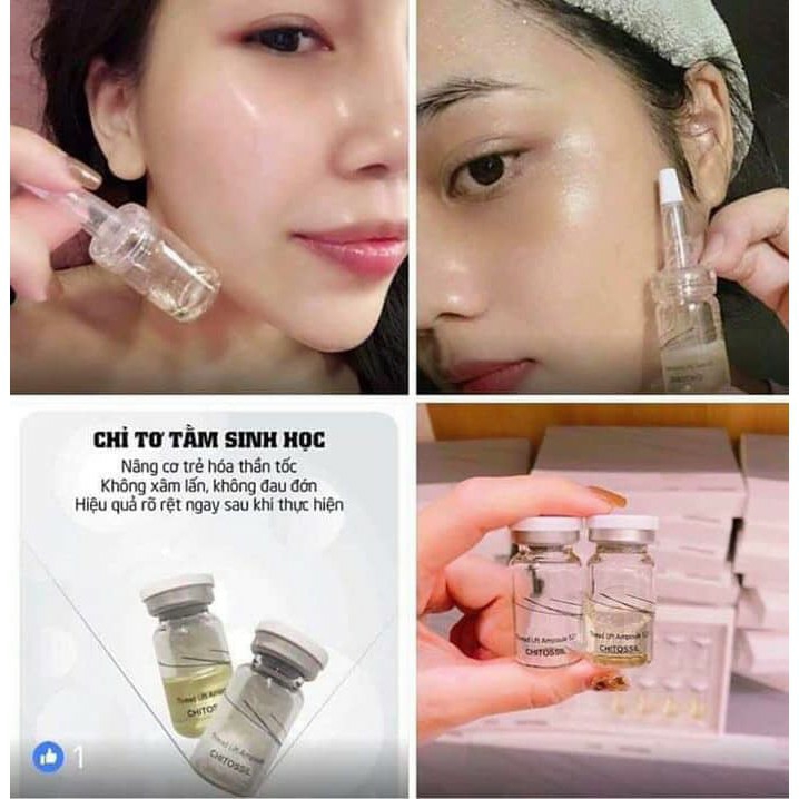 Chỉ tơ Chitossil nâng cơ mờ nhăn hiệu quả