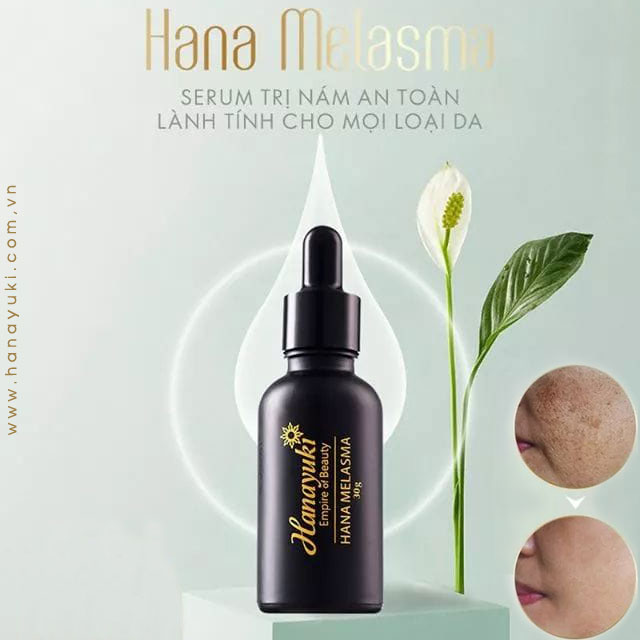 [HCM]Serum Nám Hanayuki Melasma DATE 2022