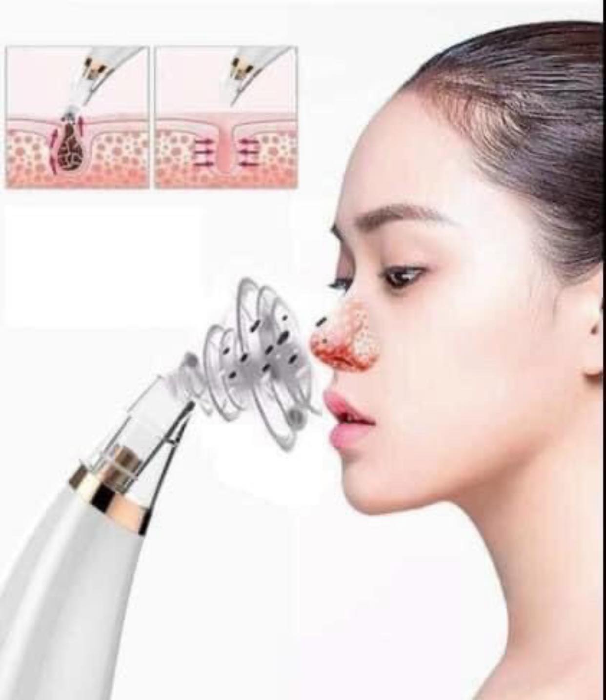 MÁY HÚT MỤN MINI