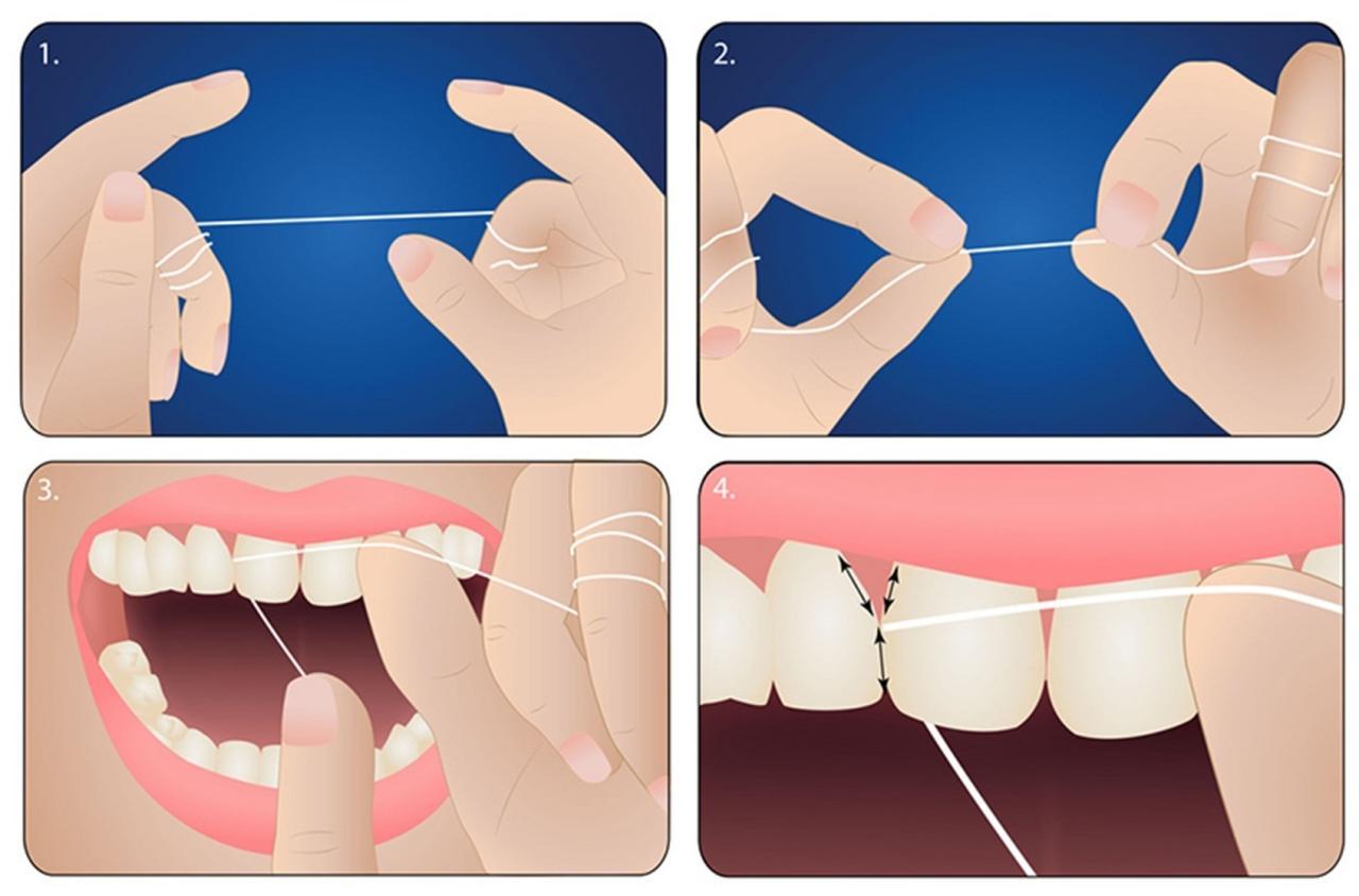 CHỈ NHA KHOA DONTODENT DÙNG CHO KHE RĂNG KHÍT - HÀNG NHẬP ĐỨC