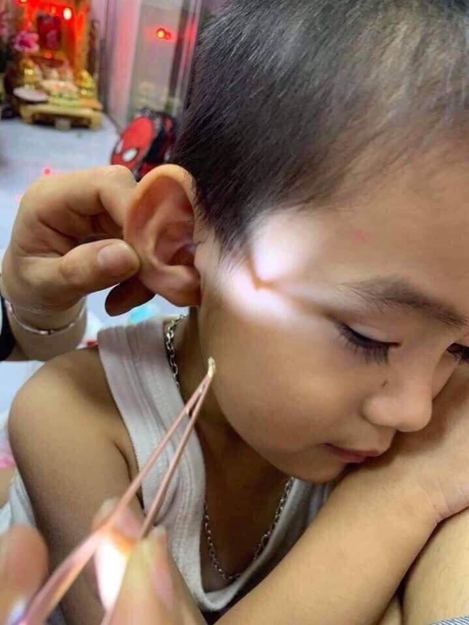 Bộ lấy ráy tai có đèn
