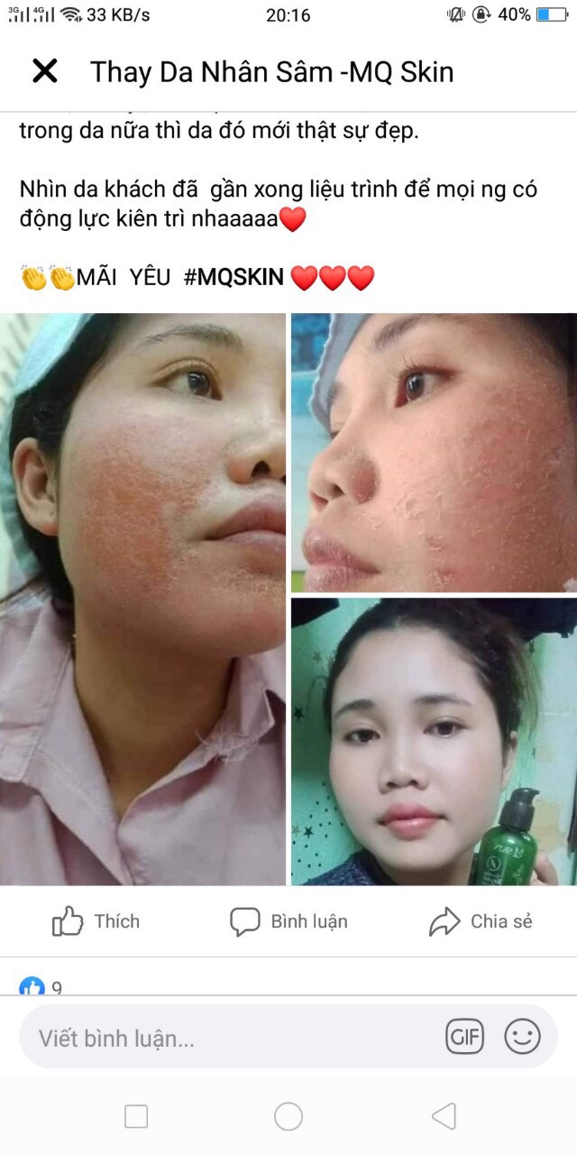 serum thay da nhân sâm mq skin- lột mạnh