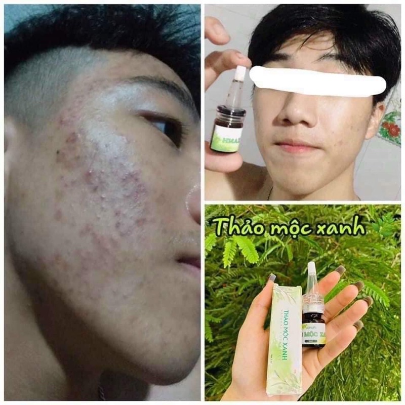 Serum Thảo Mộc Xanh Hàng Chính Hãng