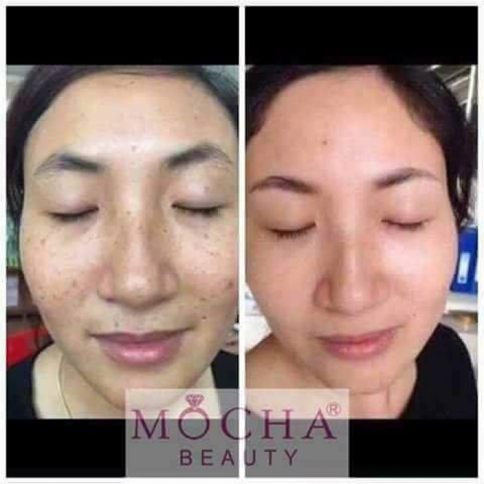 [HCM]BÁN CHẠY - KEM FACE TUYẾT SỨ MOCHA