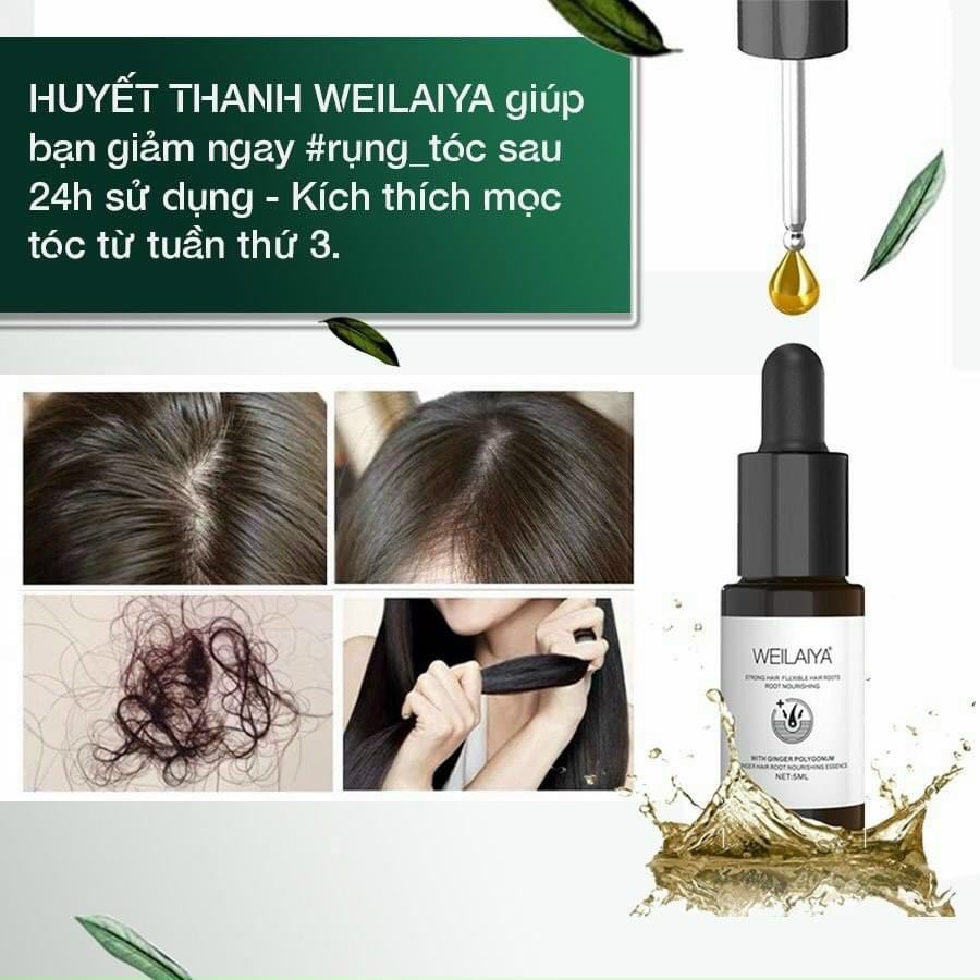 Huyết thanh Weilaiya kích thích mọc tóc, ngăn rụng tóc