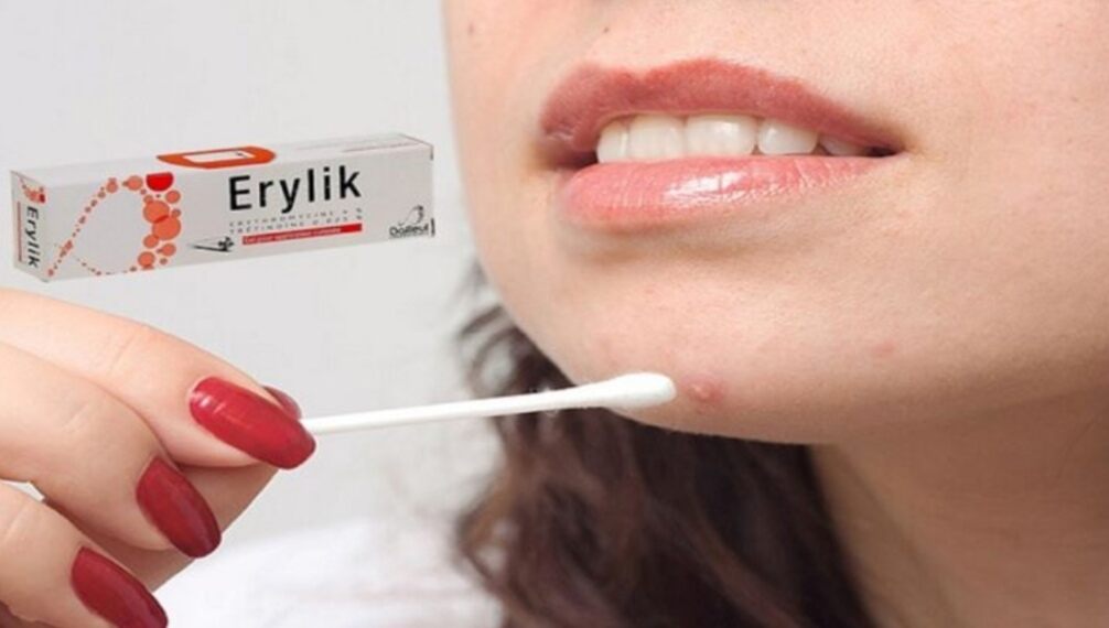 GEL CHẤM MỤN VIÊM ERYLIK ( NHẬP KHẨU TỪ PHÁP) 30g h ,