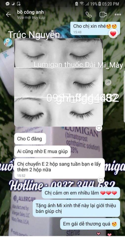 Thuốc mọc lông mày, dài mi Lumigan - Mỹ