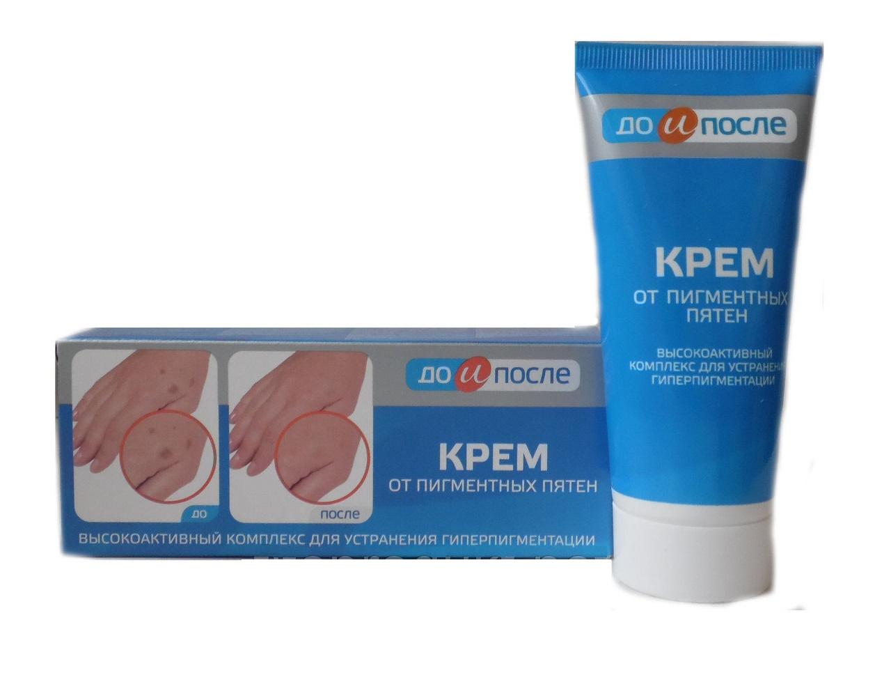 [HCM]Kem Loại Bỏ Đồi Mồi Da Tay Chân Kpem 50ml