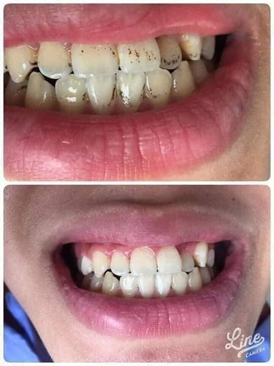 Bột than tre hoạt tính Zenpali