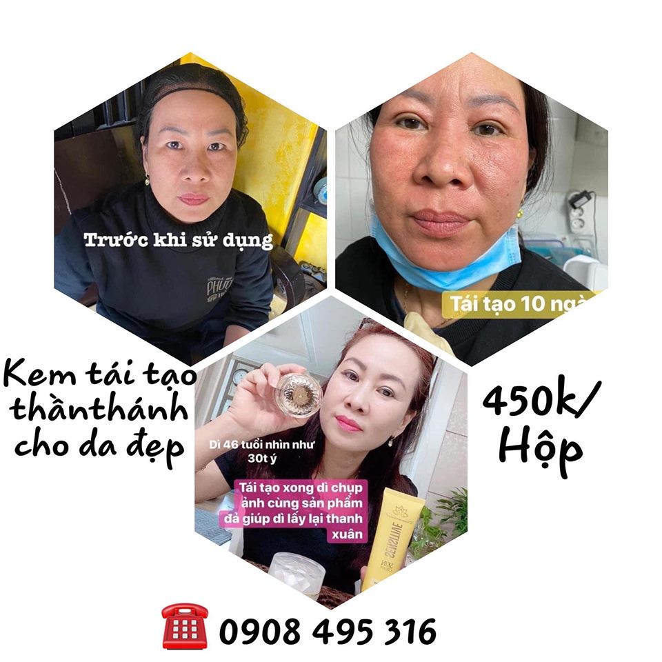 [HCM]KEM TÁI TẠO CHAMOMILESKILL