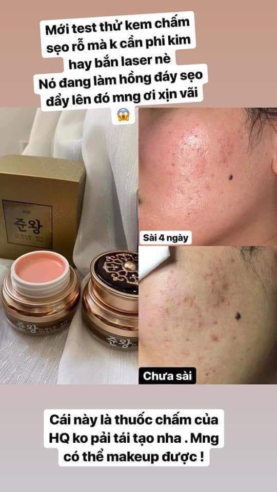 Kem Trị Sẹo Rỗ 𝙂𝙚𝙣𝙞𝙚 𝙁𝙞𝙭 𝙎𝙠𝙞𝙣 𝙉𝙤 𝙈𝙏𝙎 - 406