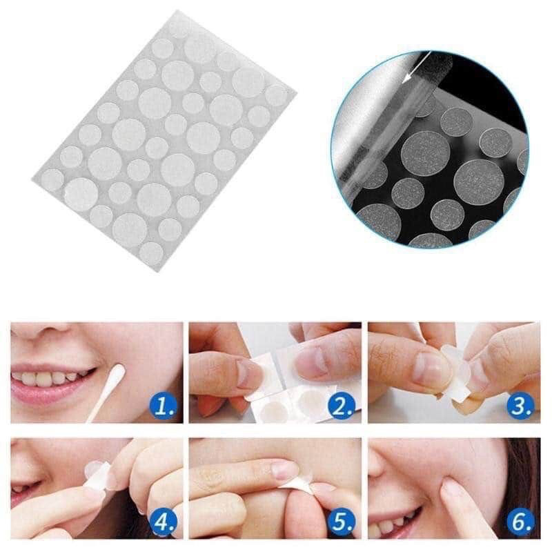 Set 36 miếng dán mụn ACNE PLASTERS, miếng dán che mụn làm xẹp che phủ mụn