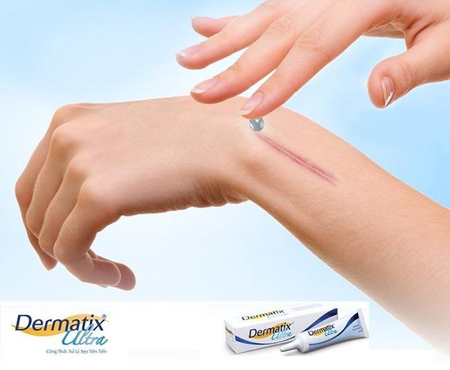 [GIẢM 20K ĐƠN 399K] Dermatix Ultra Gel Làm Mờ Sẹo 7g