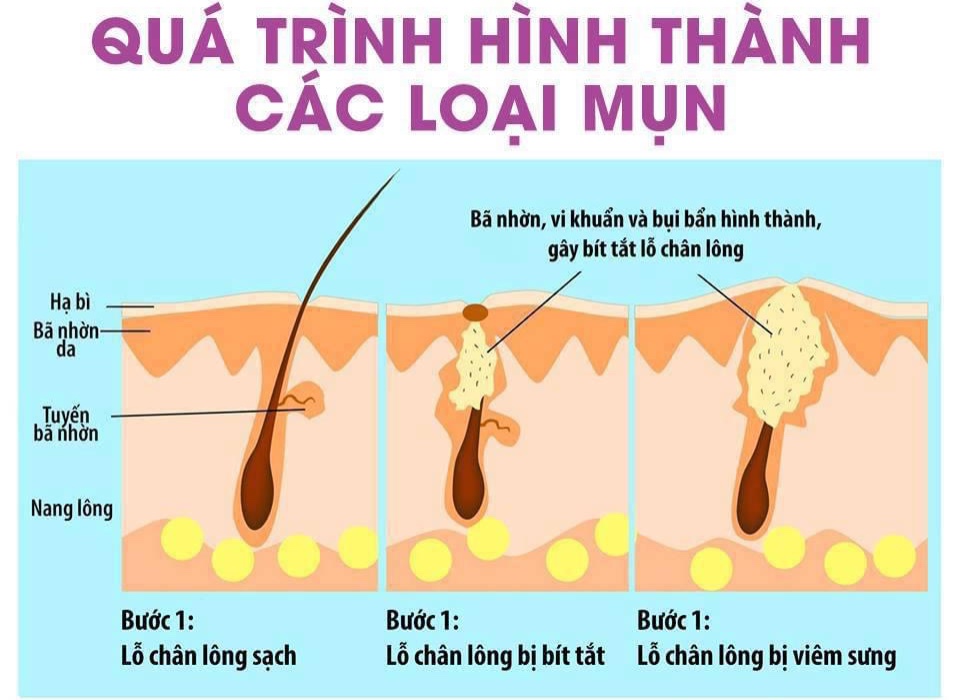 [HCM]Sữa rửa mặt hồng sâm cao cấp BN WHITE