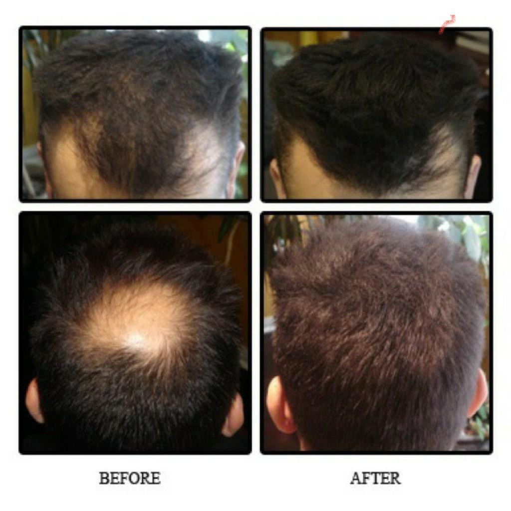 [Bán Sỉ] Bột phủ dày tóc Toppik Hair