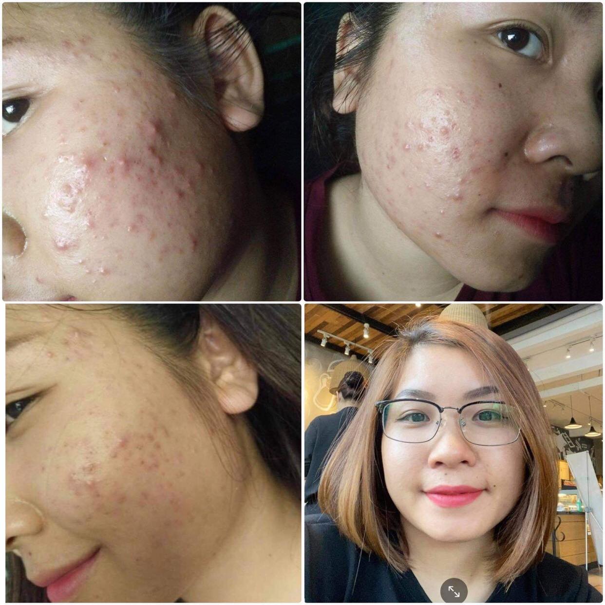 Serum thanh dược LaRe 40ml nguyên tem
