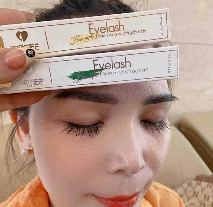 KÍCH MỌC VÀ DÀI MI PHƯƠNG ANH