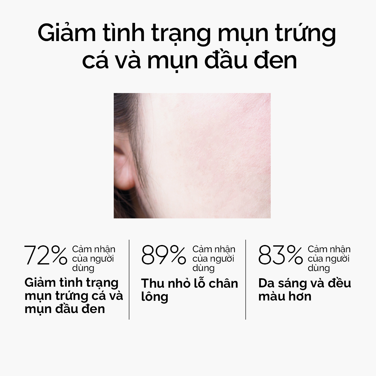 SKINTIFIC Mugwort ANTI PORES & MẶT NẠ ĐẤT SÉT Mặt Nạ bùn MỤN Mặt Nạ Cấp ẩm Mặt Nạ Ngải Cứu 55g