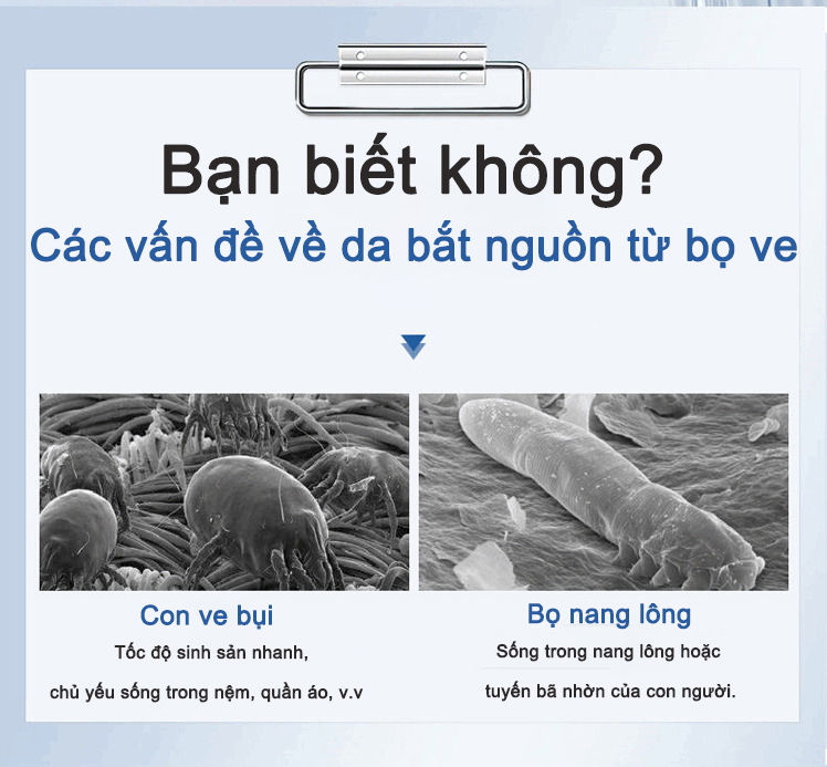 【💯Hàng thật】Sữa rửa mặt FUSHITING Azelaic Acid 100g