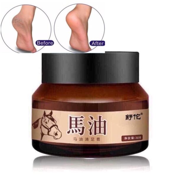 [Dầu Ngựa] Kem dầu ngựa bôi tay chân, cao ngựa giảm khô nứt nẻ gót chân á sừng bong da - CAFANI Shop9x giá rẻ