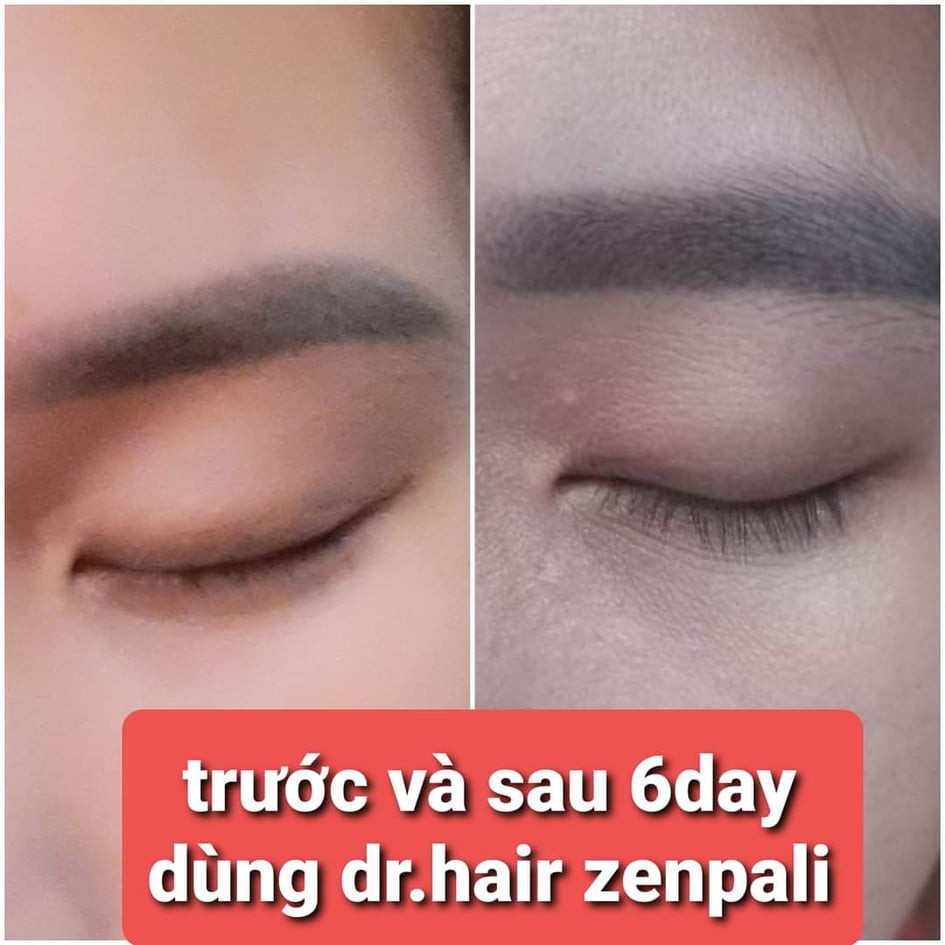 [CHÍNH HÃNG] Tinh Chất Dài Mi Mọc Tóc Dr Hair Zenpali 10ml