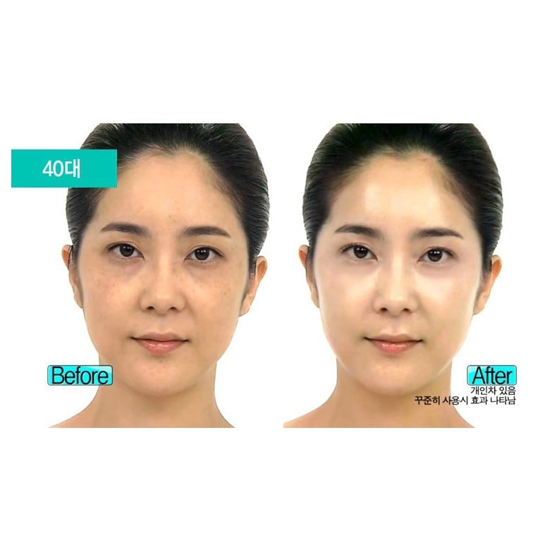 Kem Dưỡng Nâng Tone Da - Cloud 9 Whitening