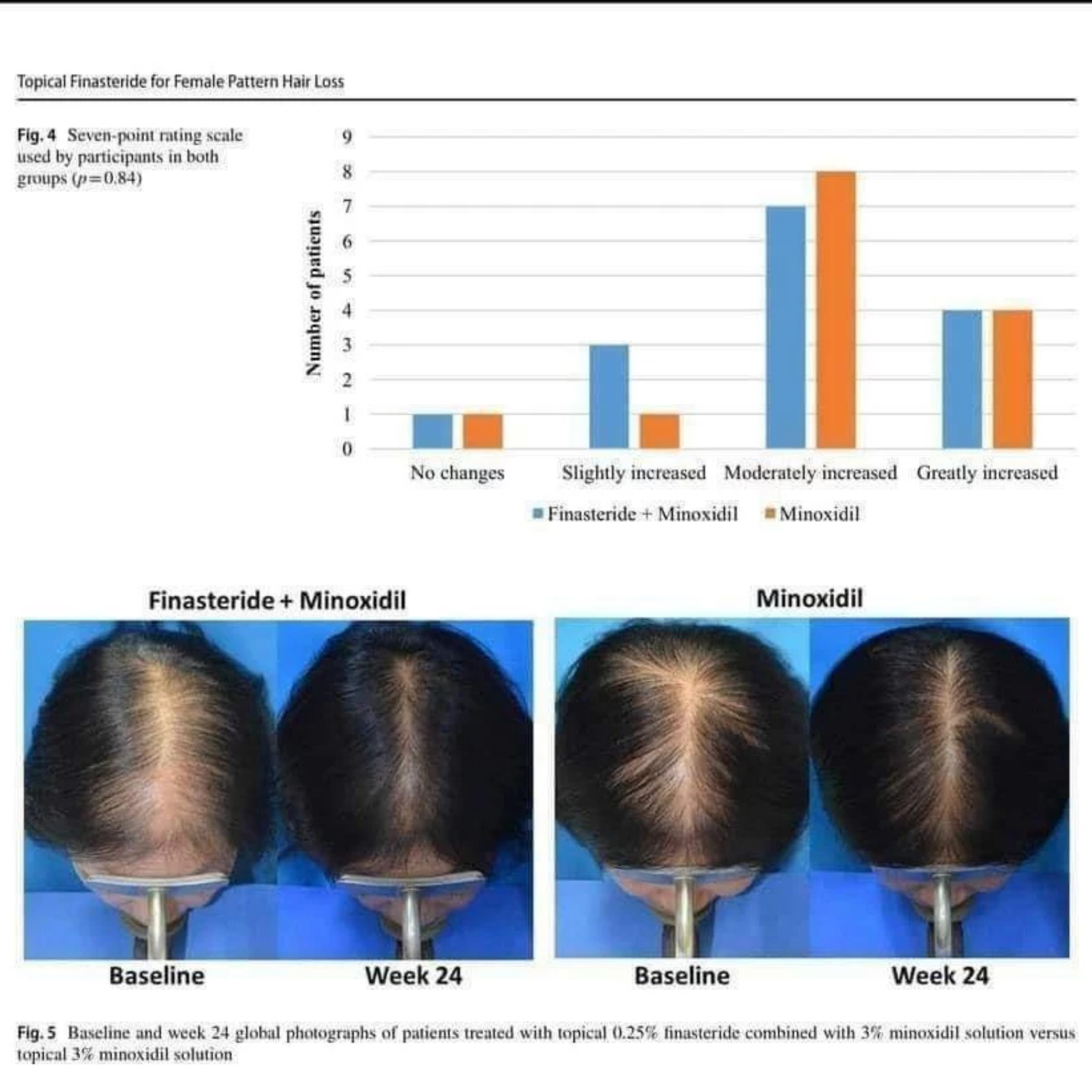 Xịt Mọc Tóc Minoxidil BAILLEUL 2%