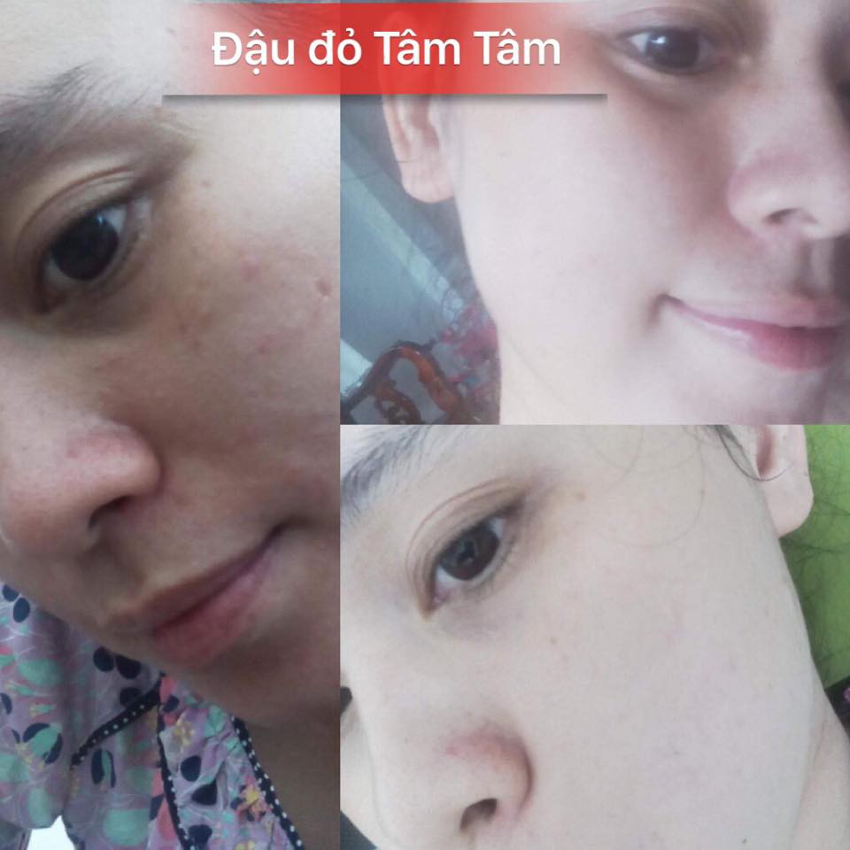 BỘT ĐẬU ĐỎ DƯỠNG DA MẶT TÂM TÂM