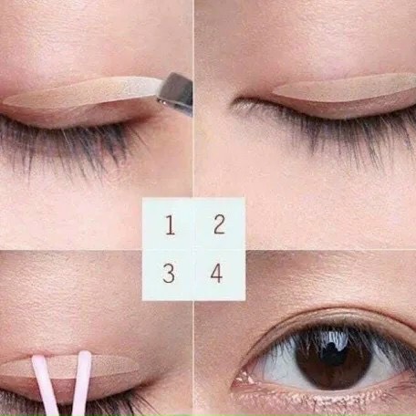 Kích mí cuộn dạng lưới Eyelid Malian