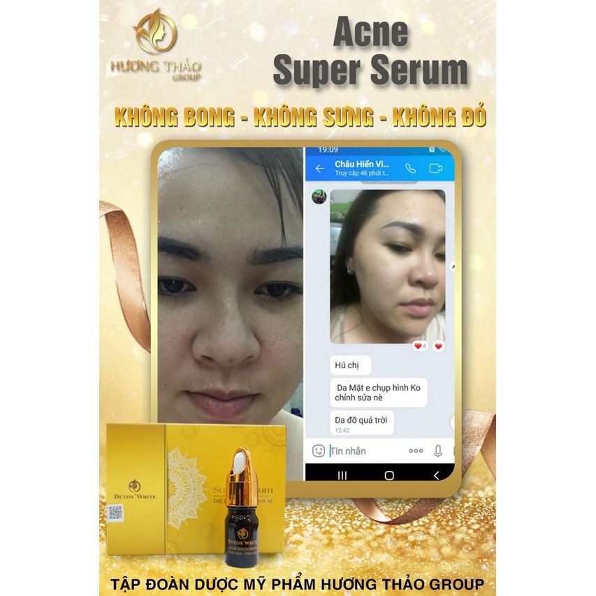 Serum  Mụn Đông Y, Detox White Acne Super Serum
