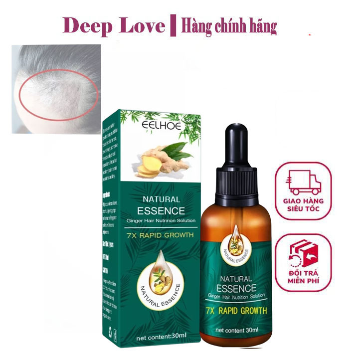 Tinh dầu kích mọc tóc nhanh ngăn ngừa rụng tóc chai tinh dầutinh chất giúp tóc mọc nhanh chống rụng tóc Tinh chất tăng trưởng tóc nhanh Hair Grower Dầu xả tóc Tinh chất ngăn ngừa rụng tóc cho nam và nữ 30ML