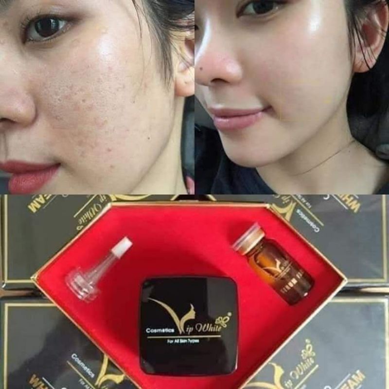 Kem face vip white - kem nám trắng da mặt vip white