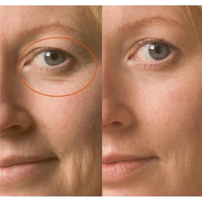 [HCM]Kem dưỡng Vita A Cream Forte RETINAL DR.DIFFERENT