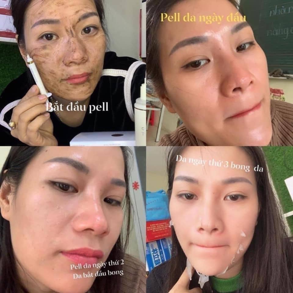 THAY DA SINH HỌC PEEL BQ CELL