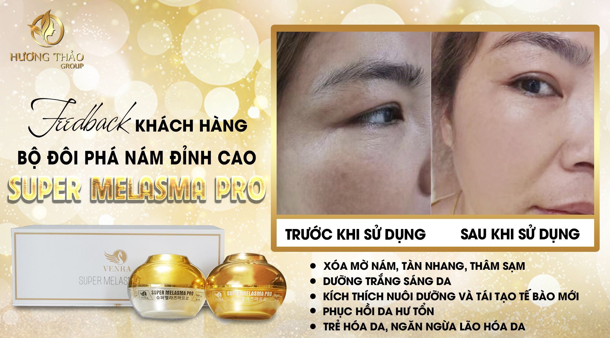 Bộ Đôi Phá Nám Đỉnh Cao Super Melasma Pro