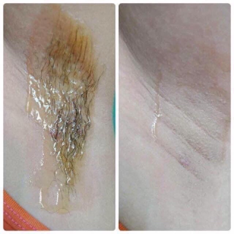 Sáp Wax Lông Honey 100% Thiên Nhiên ( Tặng 50 Tờ Giấy Và Que Wax )