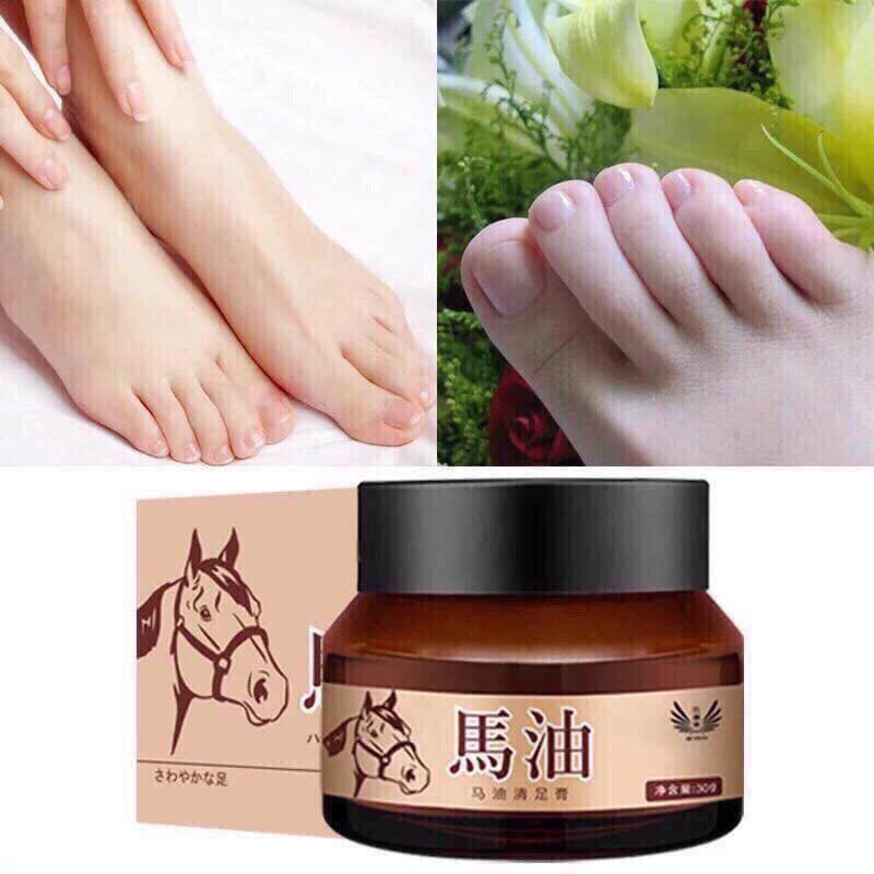 Kem dầu ngựa chuyên nứt nẻ gót chân, khô ngứa tay chân 30g Cực Hiệu Quả