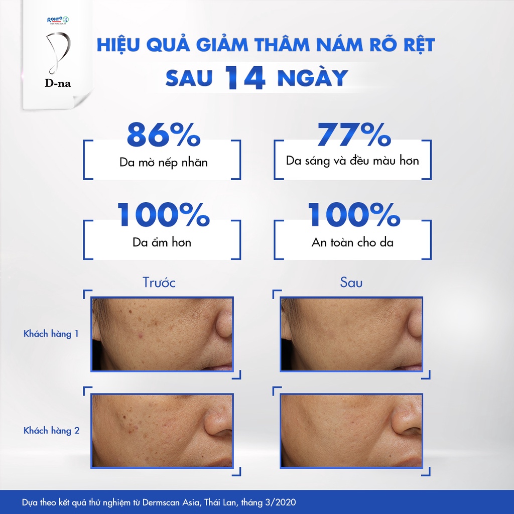 [VB] Combo Viên uống sáng da D-na ( Hộp 60 viên)