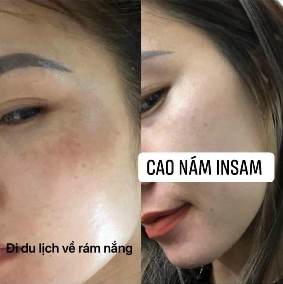 Cao Nám Insam Dr Cell 20g mờ thâm nám tàn nhang trắng da trẻ hoá da