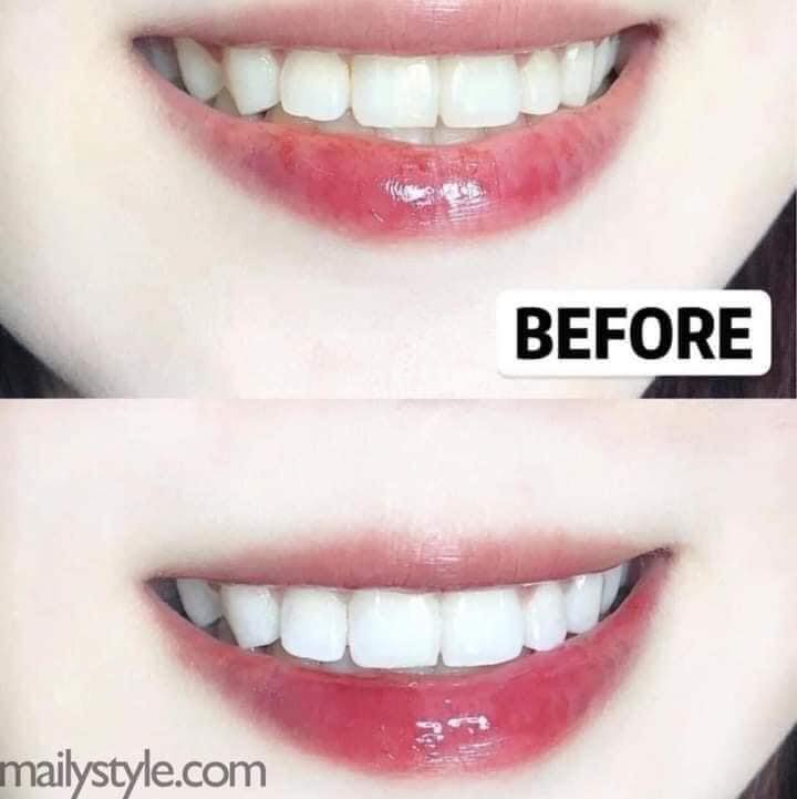 Kem Đánh Răng Median Dental IQ 93% Toothpaste 120g